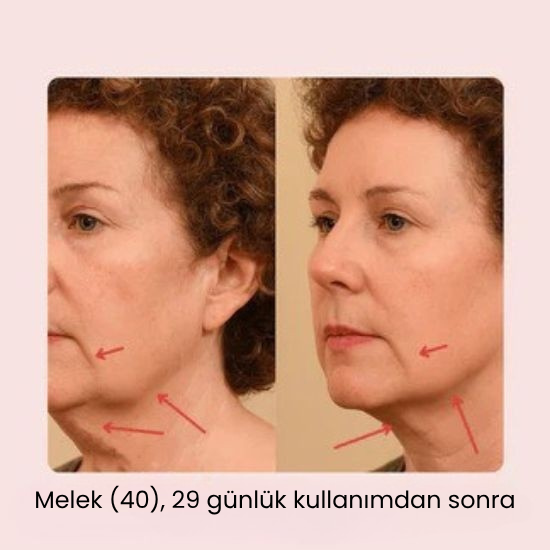 V-Line Yüz Germe Maskesi